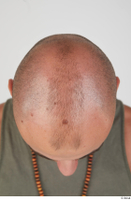 Photos Dylan Parker bald head 0006.jpg